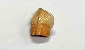 رونمایی از دندان انسان ۱۰۰ هزار ساله در قزوین